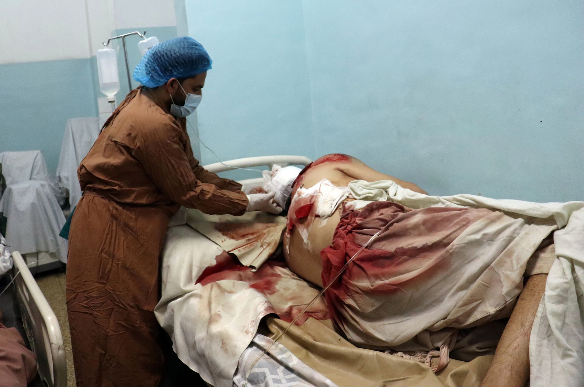 2021年8月26日，一名在阿富汗喀布尔机场外的致命袭击中的伤者在医院接受医疗援助。（AP）
