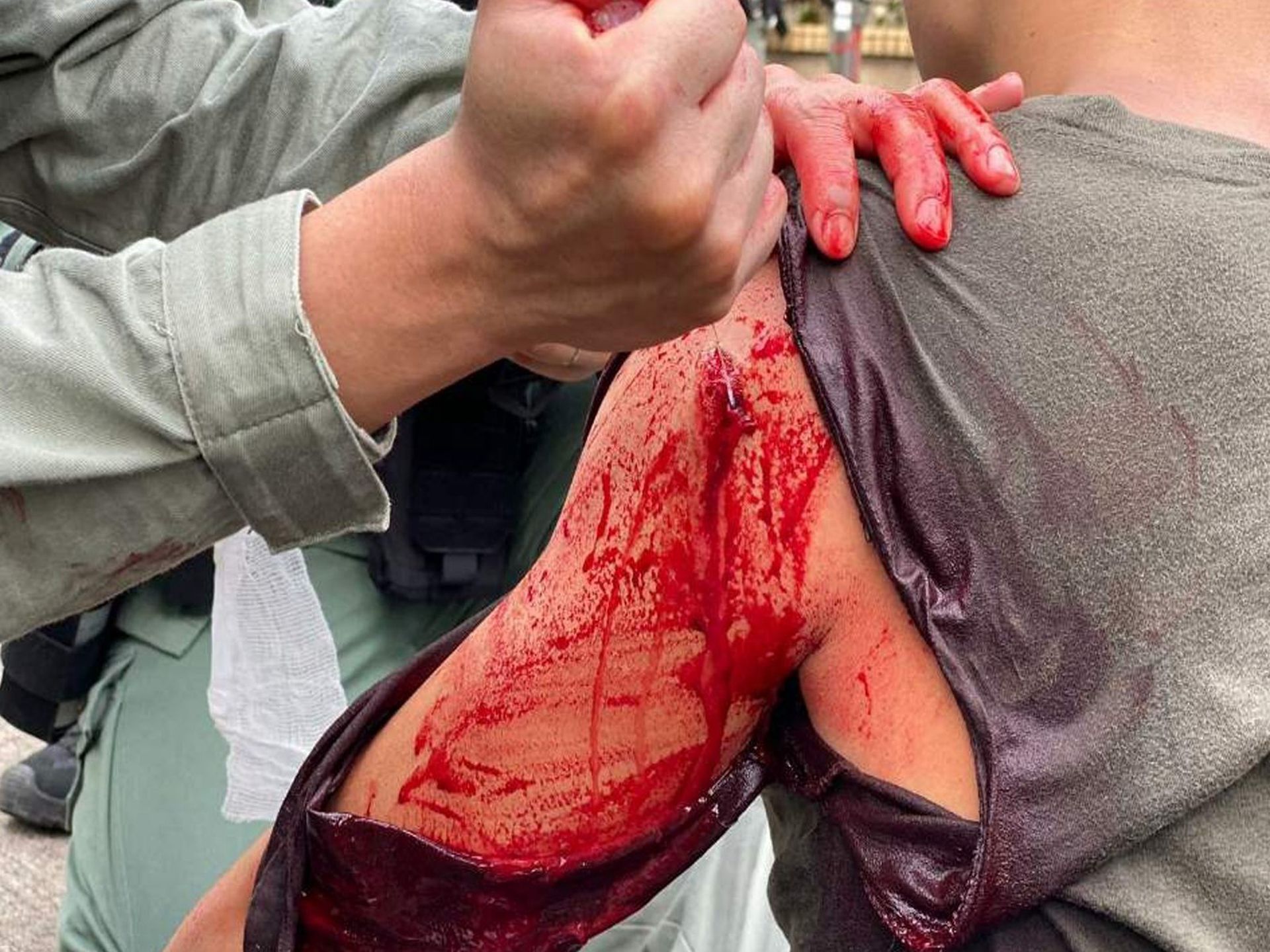 港警被暴力示威者刺伤后画面。（HK01）