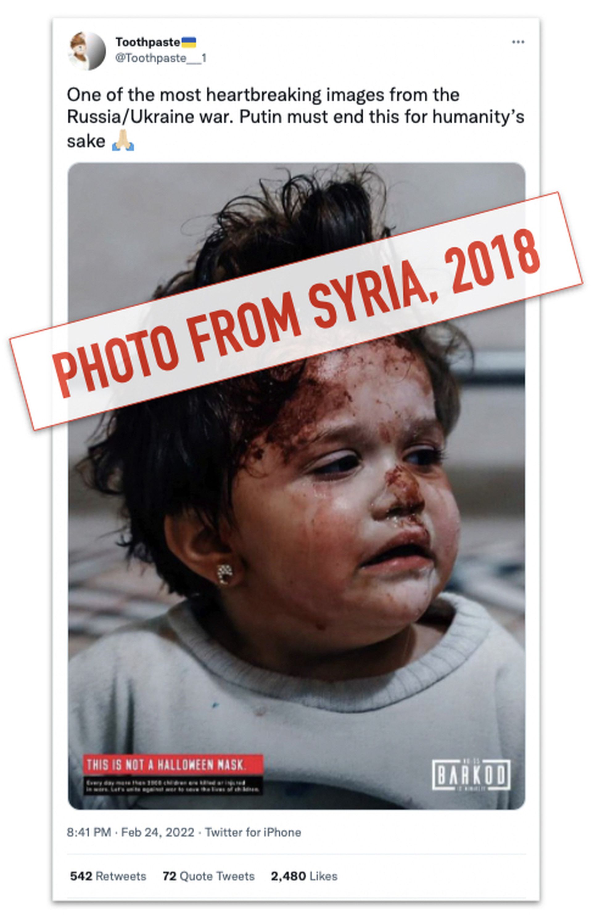 一张来自2018年叙利亚战争女孩受伤的照片，在此次俄乌冲突中被大量转发，其后证实为假资讯。（网络截图）