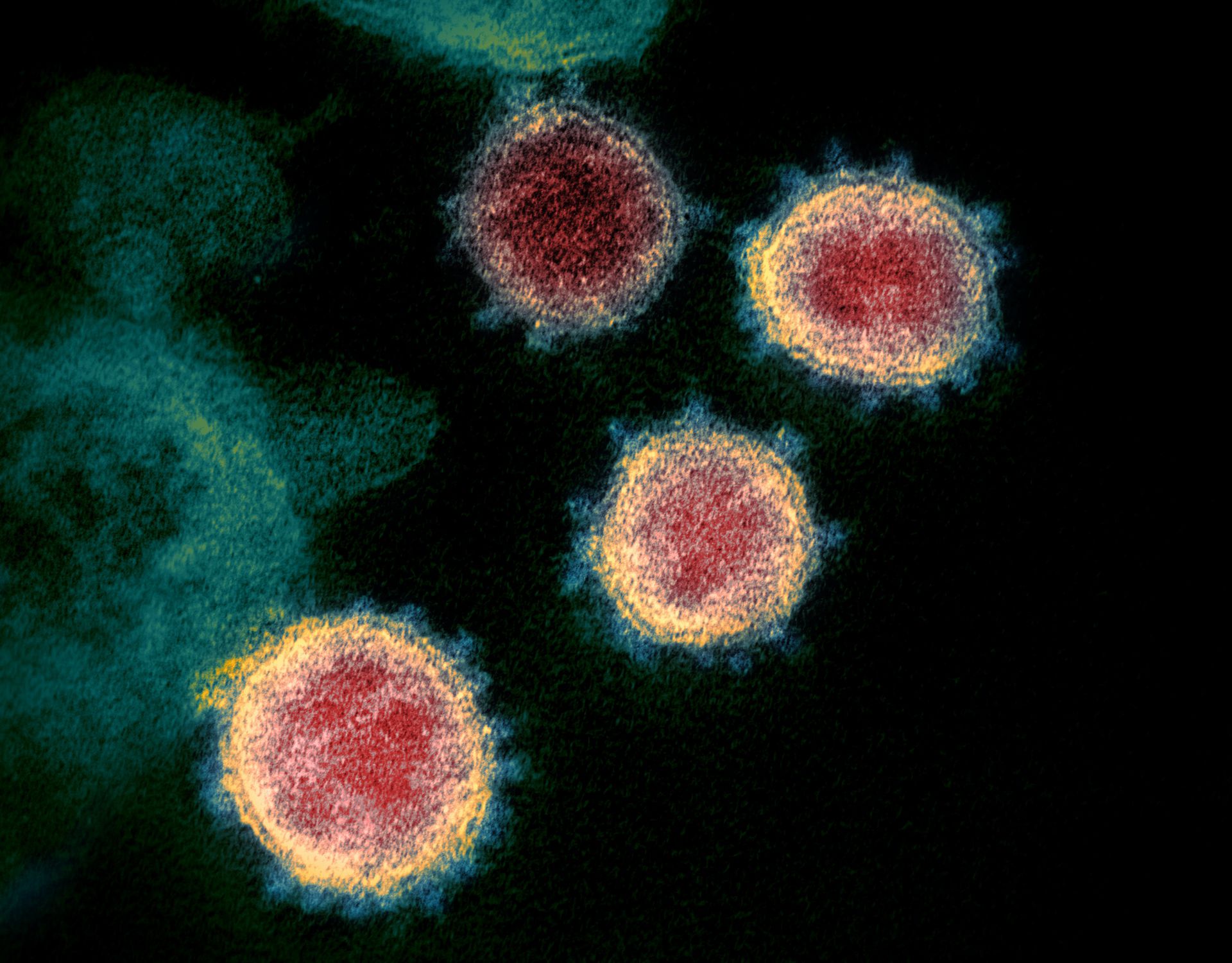 美国情报部门公开疫情源头报告　判断病毒并非生化武器